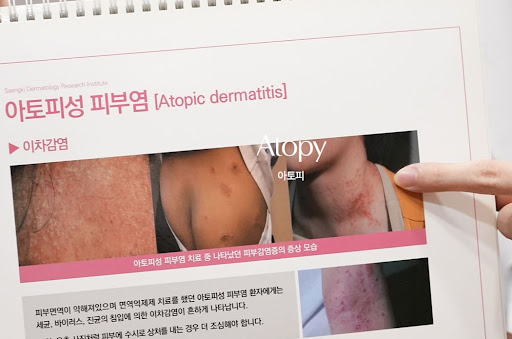 생기한의원이 안내하는 아토피 증상이 반복될 수 있는 이유
